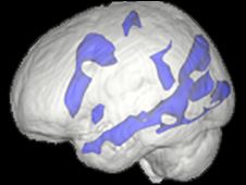 Brain activity in a personal not used to using the web while reading