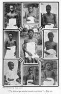 Congo wiki